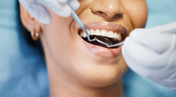 Best Knocked-Out Tooth Emergency  in Lucas, TX