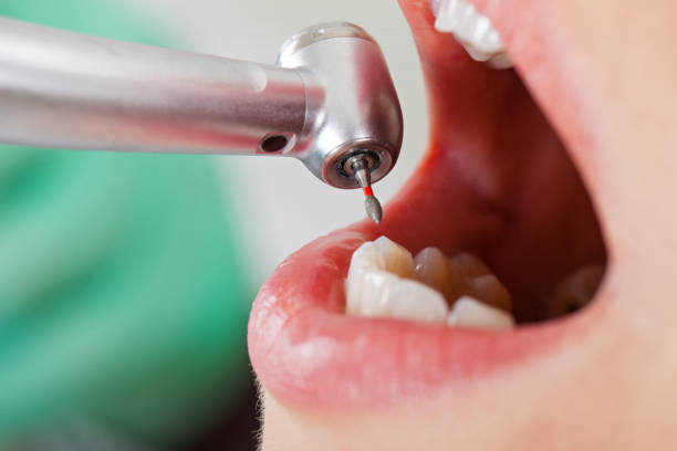 Best Dentist for Tooth Abscess  in Lucas, TX